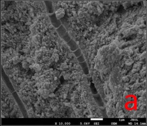 Evaluation of Five Different Desensitizers: A Comparative Dentin Permeability and SEM Investigation 