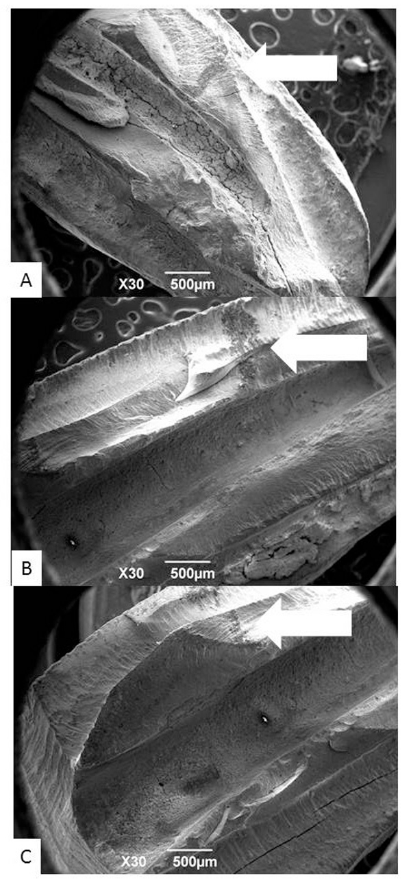 
                     Smear Layer Removal Efficacy of Two Activated Irrigation Techniques After Reciprocating Instrumentation in Curved Canals
                