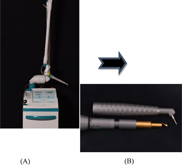 Laser Assisted Non-surgical Periodontal Therapy: A Double Blind, Randomized Clinical Trial