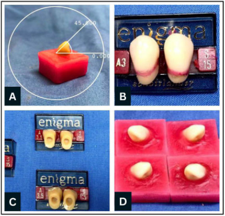 Evaluating Tooth–denture Base Bonding Performance in Conventional and CAD/CAM Denture Bases with Different Surface Treatments: An Study