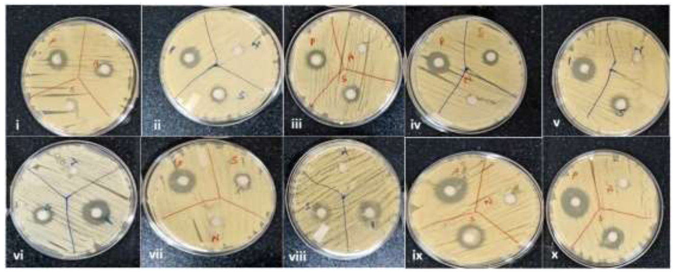 An  Evaluation of Antifungal Efficacy and Tensile Strength of Denture Tissue Conditioner with Indian Turmeric Oil