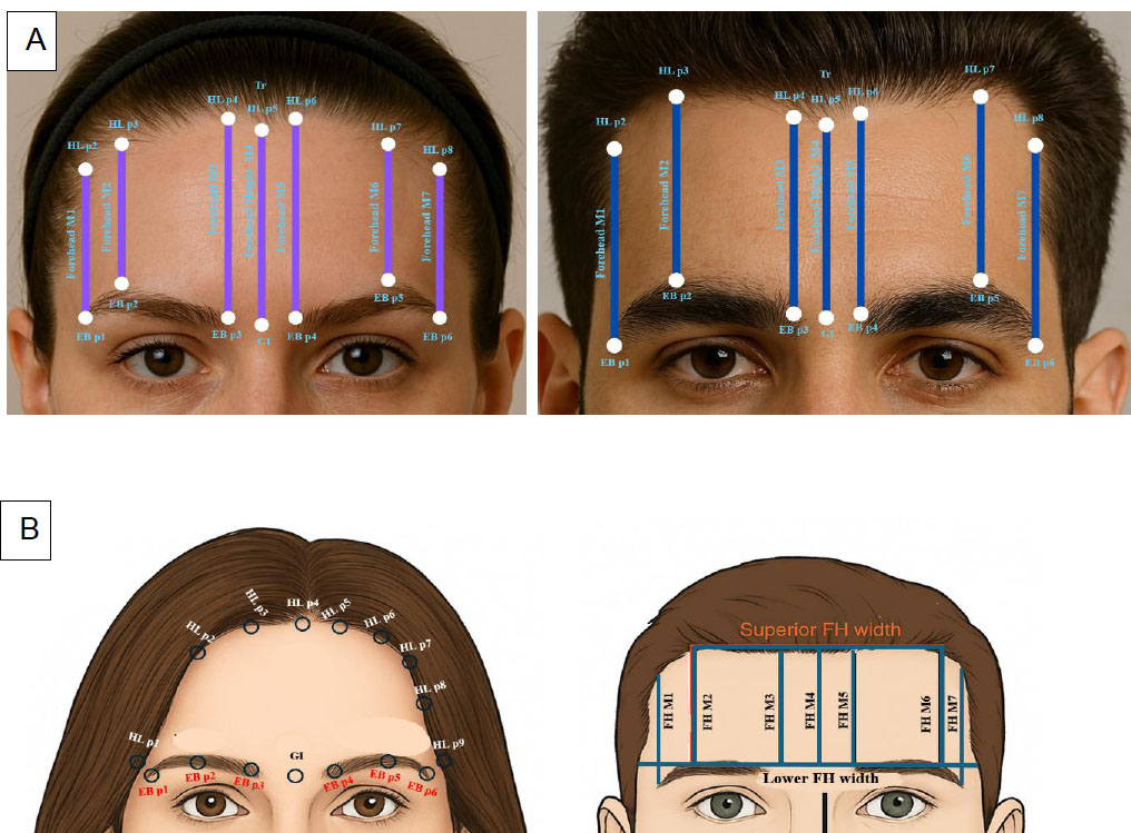 Forehead Anthropometrics of Jazan Population, Saudi Arabia: A Prospective Analytical Study