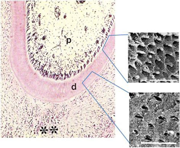 Structural and Ultra-Structural Features of the First Mandibular Molars of Young Rats Submitted to Pre and Postnatal Protein Deficiencies