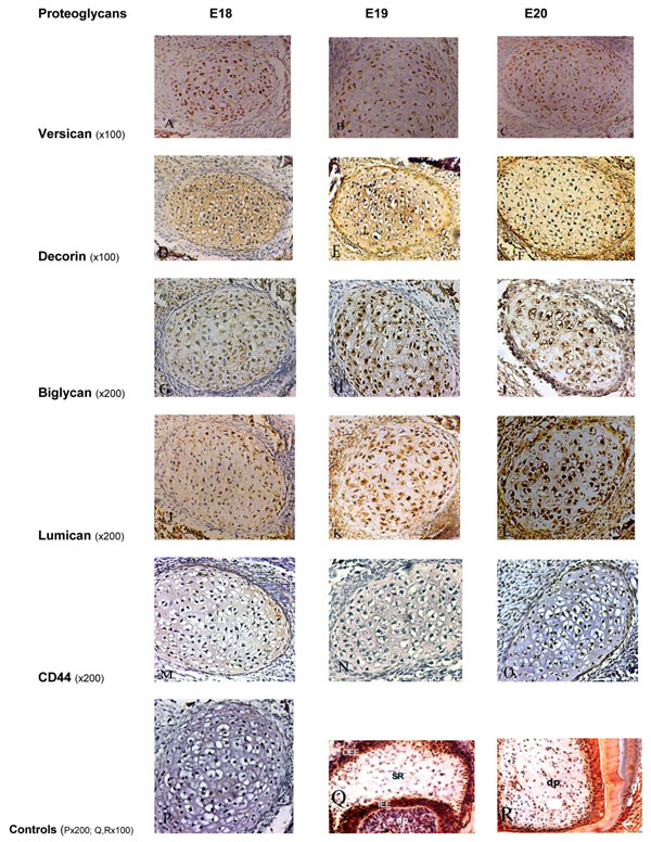Immunolocalization of Proteoglycans in Meckel’s Cartilage of the Rat