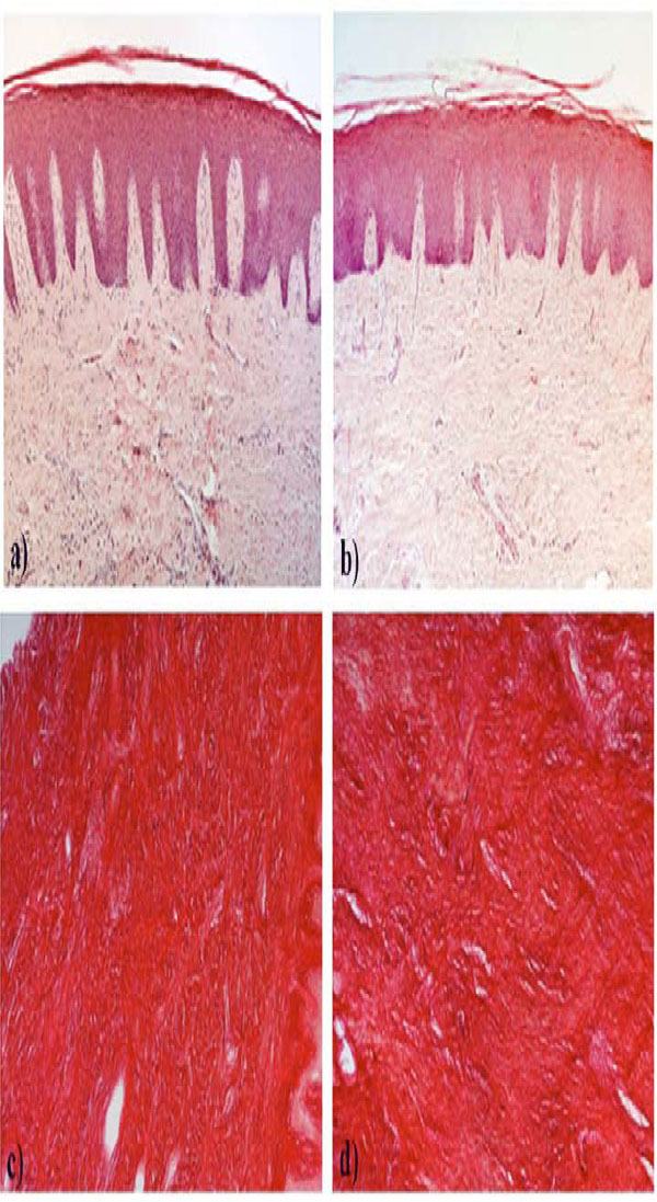 Effects of Aging and Cyclosporin A on Collagen Turnover in Human Gingiva