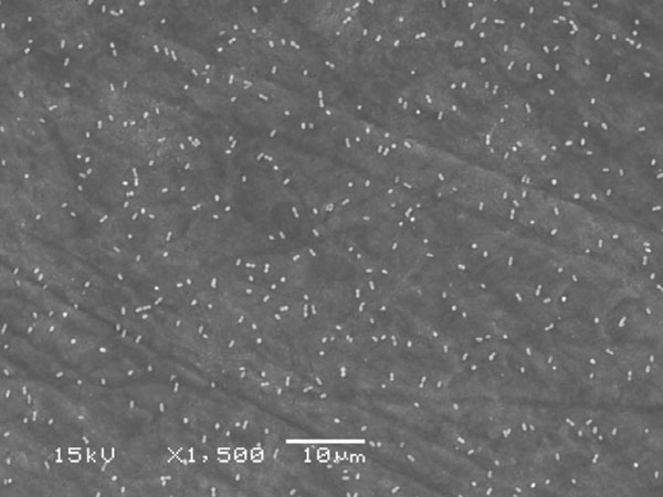 Adherence of  to Fiber-Reinforced Filling Composite and Conventional Restorative Materials
