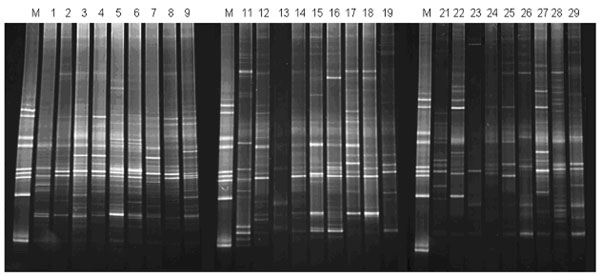 Bacterial 16S rRNA/rDNA Profiling in the Liquid Phase of Human Saliva