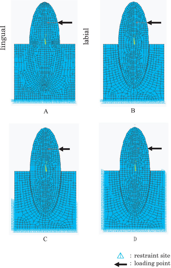 Characteristics of the Tooth in the Initial Movement: The Influence of the Restraint Site to the Periodontal Ligament and the Alveolar Bone
