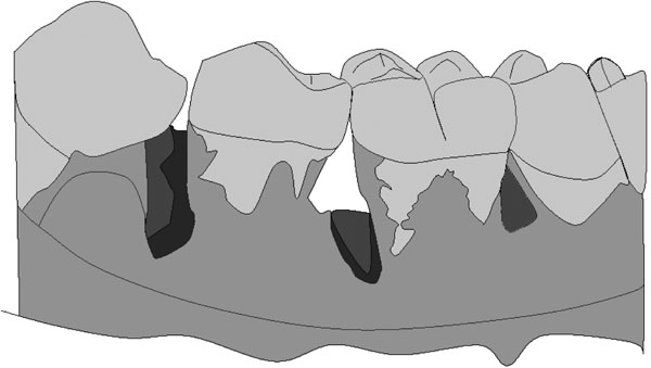 Experimental Animal Models in Periodontology: A Review