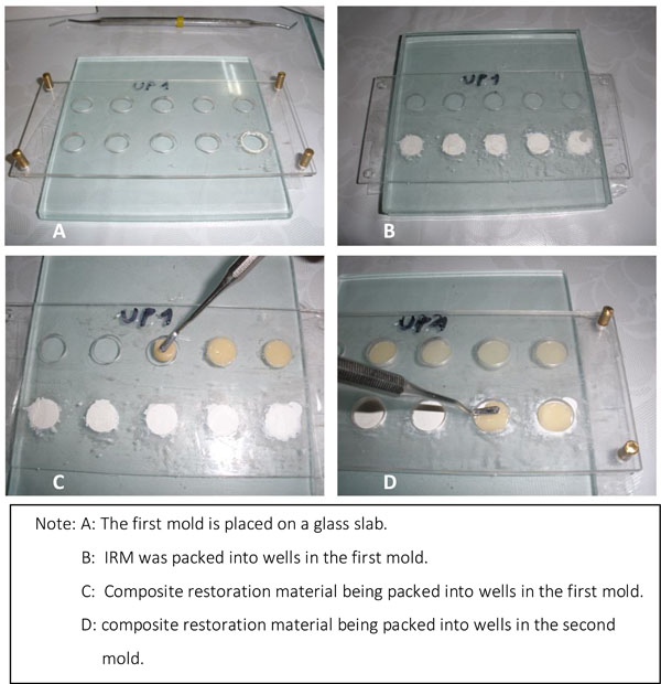 The Influence of Zinc Oxide Eugenol (ZOE) and Glass Ionomer (GI) Base Materials on the Microhardness of Various Composite and GI Restorative Materials