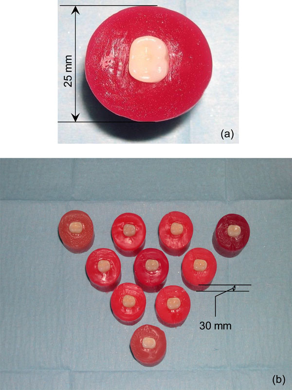 A Comparison of Shear Bond Strength of Ceramic and Resin Denture Teeth on Different Acrylic Resin Bases