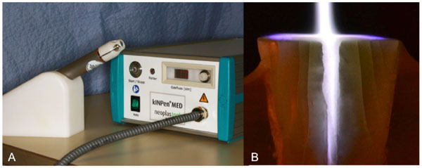 Bactericidal Efficacy of Cold Plasma at Different Depths of Infected Root
Canals In Vitro
