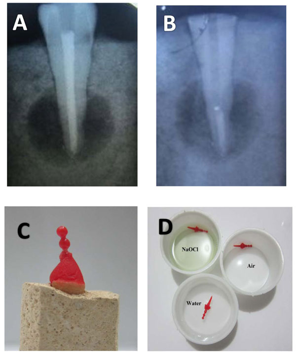  The Effect of Time and Storage Environment on Dimensional Changes of Acrylic Resin Post Patterns