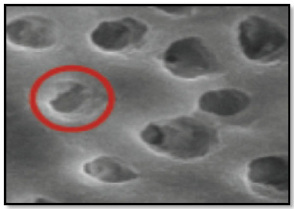  Effects of Citric Acid and Desensitizing Agent Application on Nonfluorosed and Fluorosed Dentin: An In Vitro Sem Study